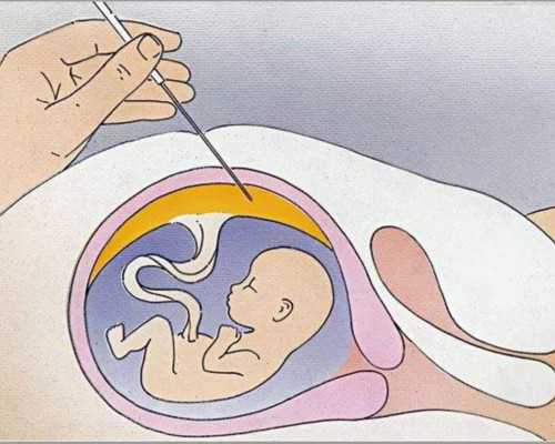 怎么代生,北京做助孕男孩过程-正规试管供卵中心